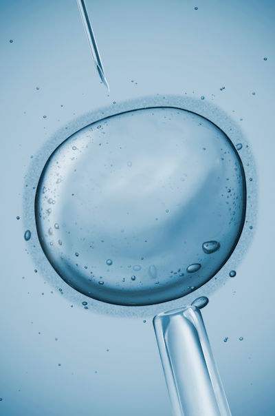 Boostanfar Fertility serving greater Los Angeles and Encino, CA with IVF services.